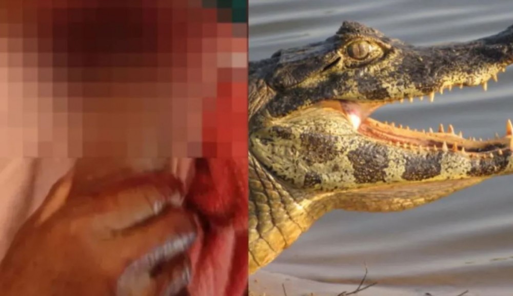 Homem tem braço dilacerado durante ataque de jacaré