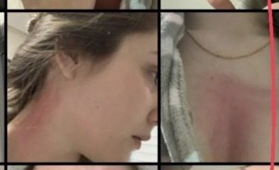 'Ladrão sim, agressor não': assaltante rouba celular e expõe agressões com fotos e prints