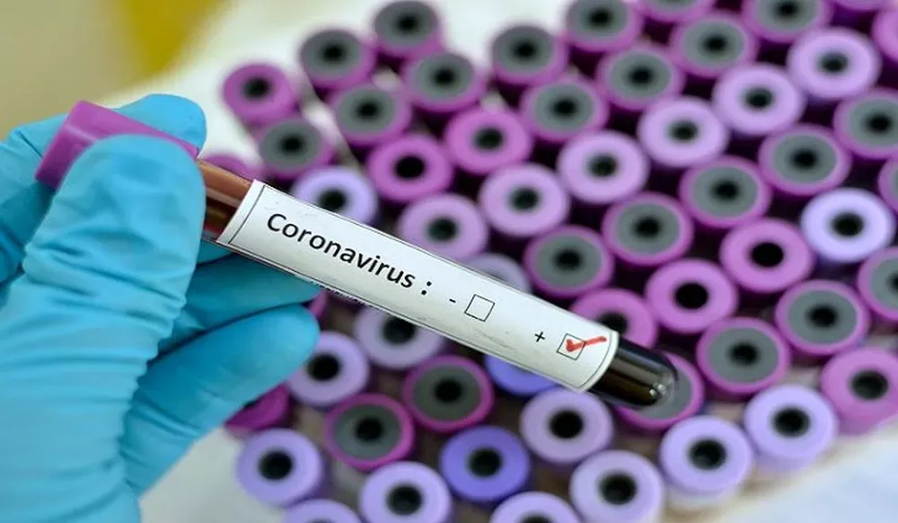 Covid-19: MS confirma mais 100 casos de coronavírus em 24 horas