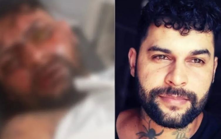 Tatuador vende tudo para sobreviver após ataque com soda cáustica que o deixou cego em MS