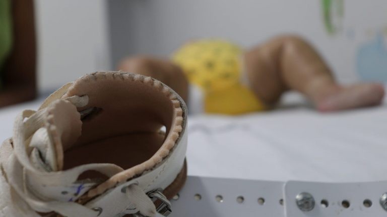 Crianças com deformidades ortopédicas têm vidas transformadas com acesso a cirurgias e tratamento adequado