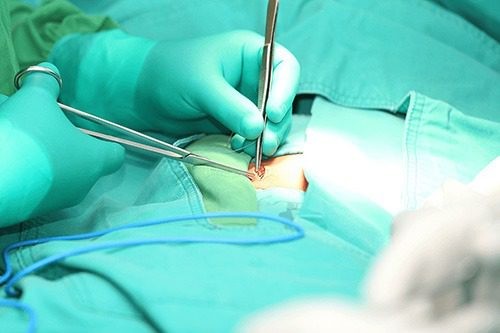 Opera MS realizará 2,6 mil cirurgias e procedimentos eletivos no SUS