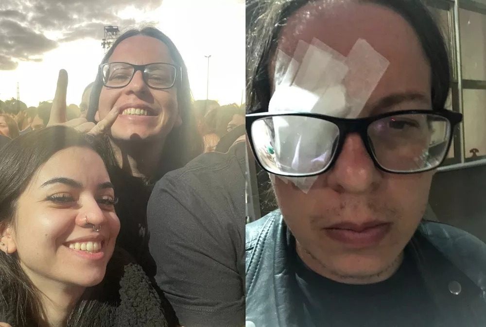 Músico de MS sofre grave lesão no olho em show do Metallica em Porto Alegre