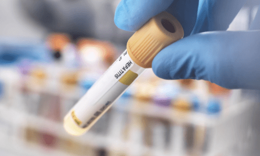 Saúde investiga 3 casos suspeitos de hepatite misteriosa em crianças de MS