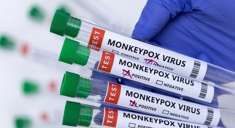 Saúde estuda compra de vacina contra varíola dos macacos e busca amostra do vírus