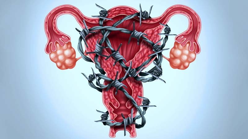 TPM e endometriose: como afetam a vida da mulher?
