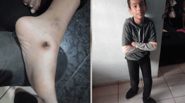 Pai rifa o próprio carro para que filho realize cirurgia de R$155 mil