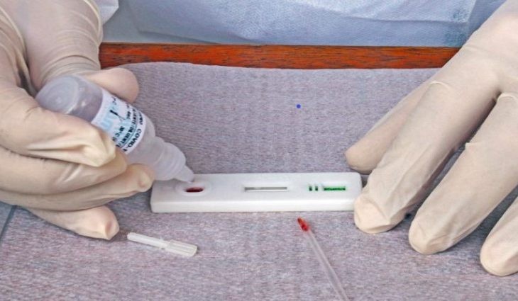 MS registra 2,6 mil casos e 16 novos óbitos por Covid
