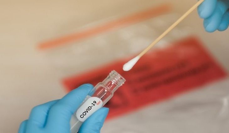 Mato Grosso do Sul registra quatro mortes e 420 novos casos de Covid-19 na última semana