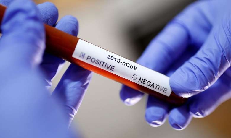 MS registra 349 casos e 5 mortes por Covid-19 na última semana