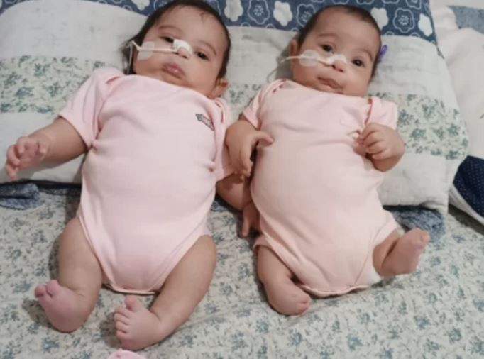 Mãe faz vaquinha para que filhas façam cirurgia de R$ 500 mil em MS